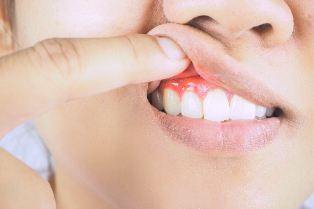 dangers untreated gum disease